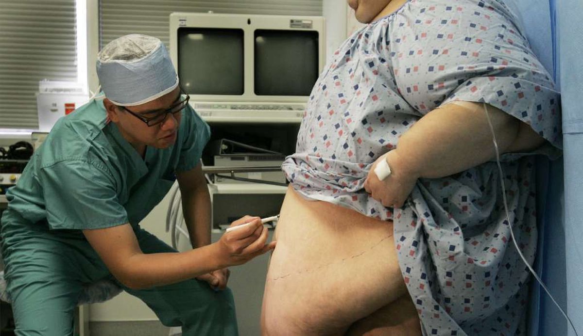 Bariatric surgery