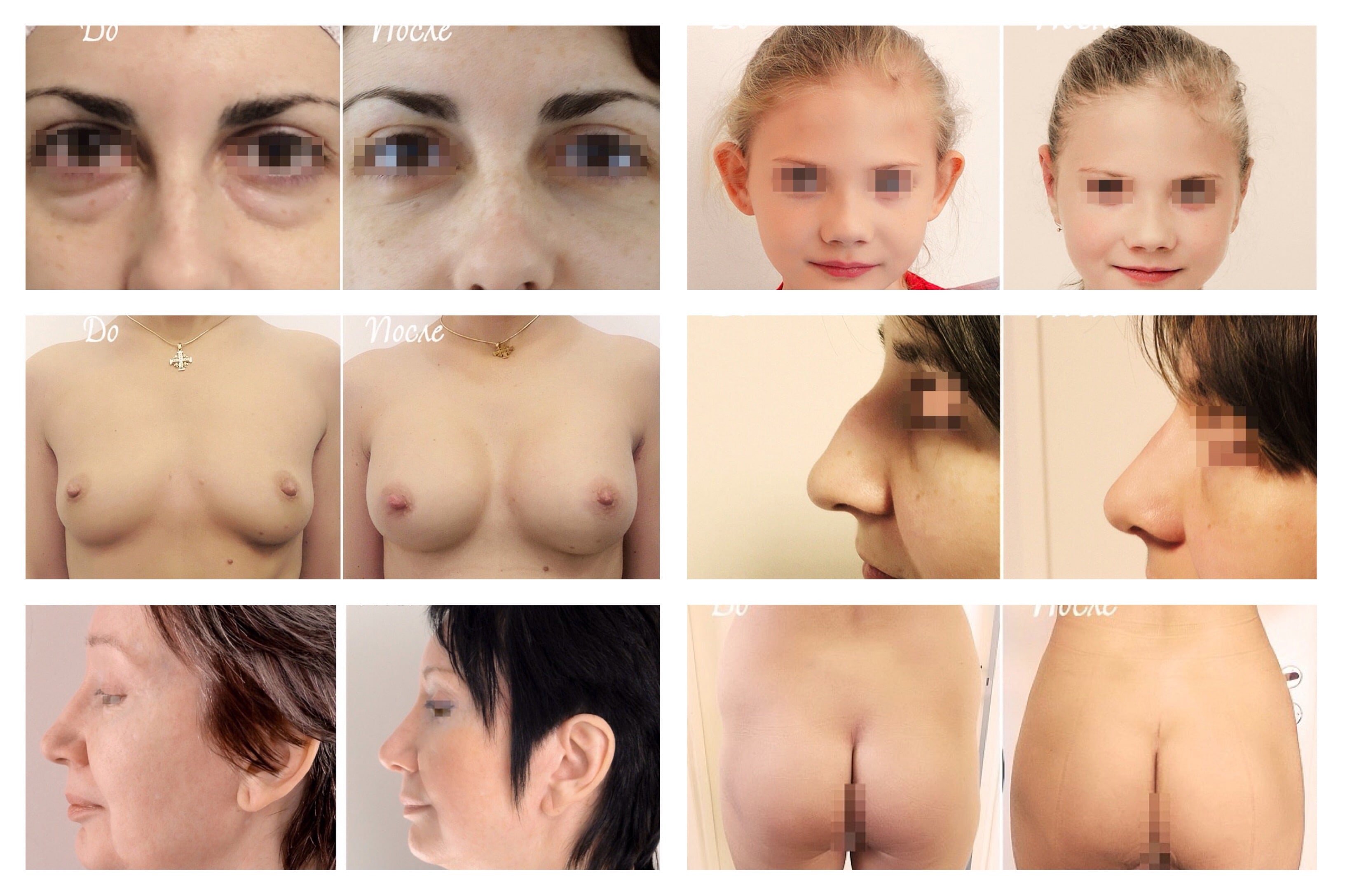 Plastic surgery in Moscow, Russia
