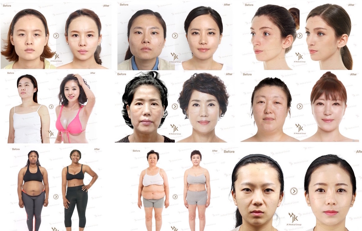 Plastic surgery in South Korea